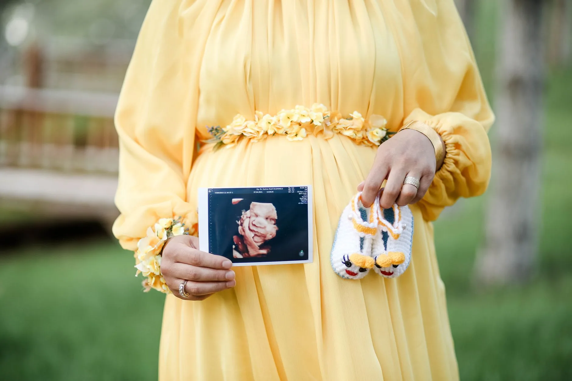 Mama Olmak Moda Oluyor! Son Moda Maternite Trendleri ve Stilleri